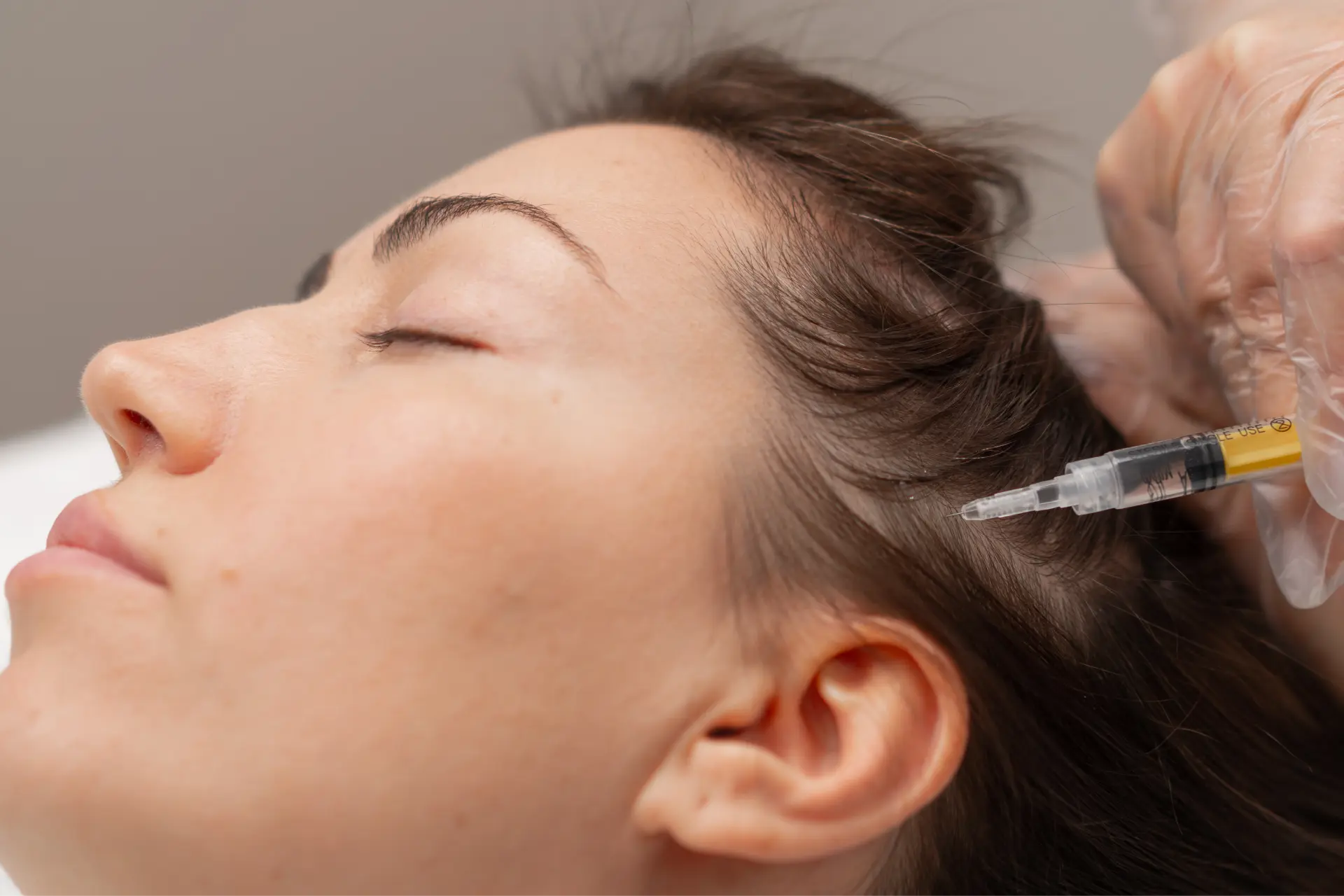 adult-getting-head-injections-for-hair-growth-2026-01-07-06-25-42-utc