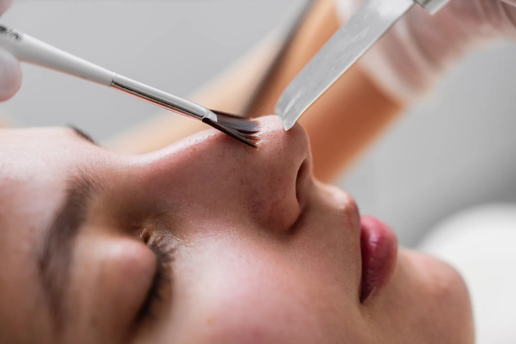 close-up-of-a-skincare-treatment-being-performed-o-2026-03-20-00-52-38-utc