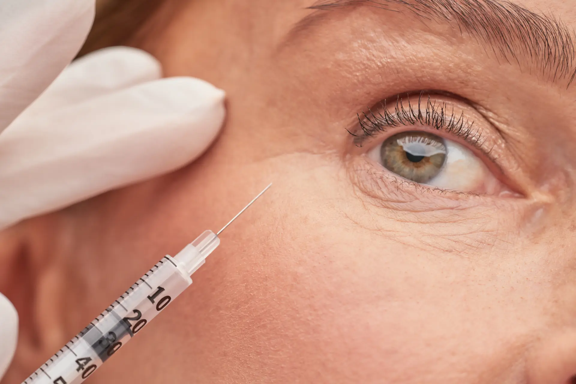 close-up-of-aesthetic-procedure-near-the-eye-2026-03-24-04-47-52-utc