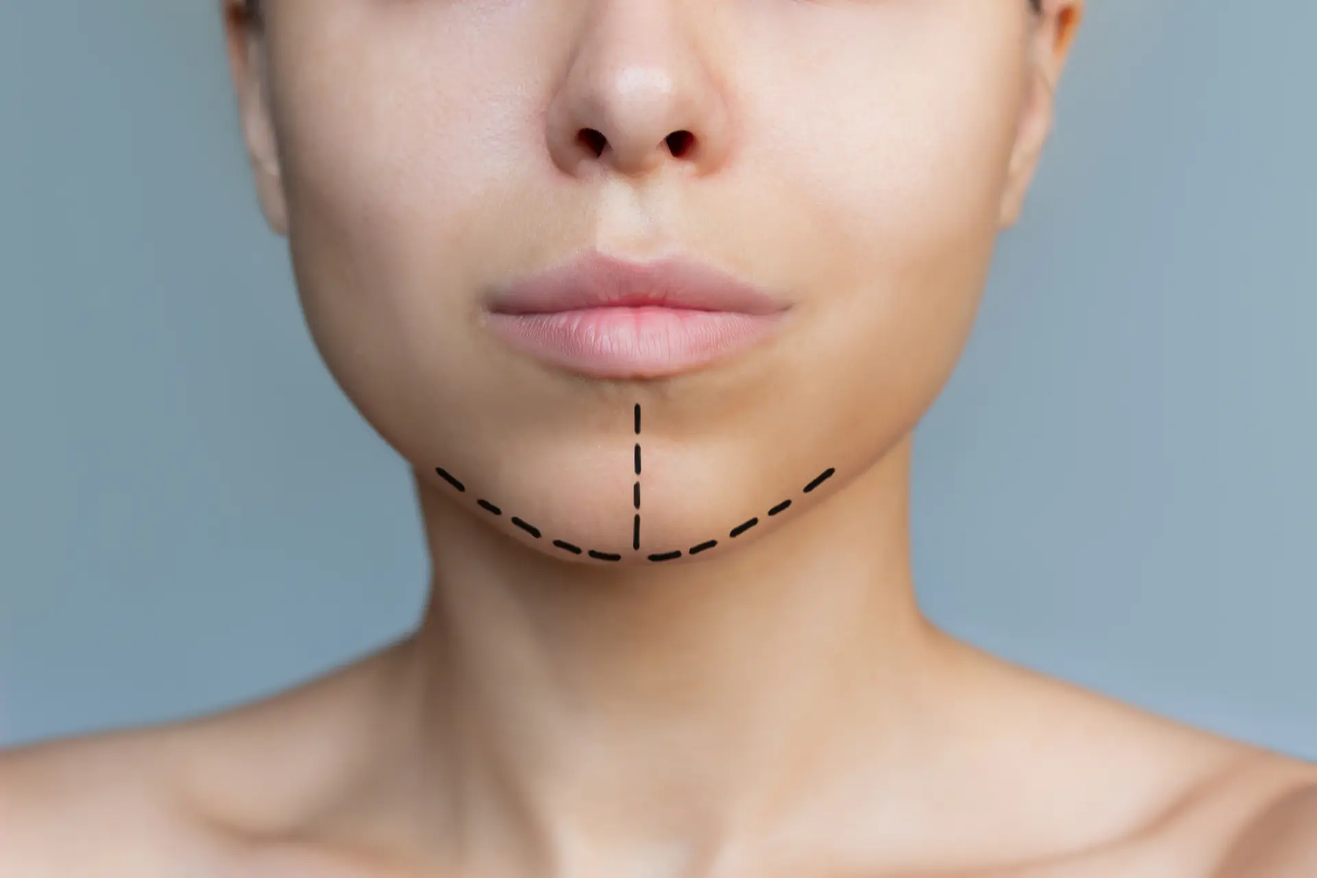 cropped-shot-young-caucasian-woman-with-marking-her-chin-facial-plastic-surgery-concept