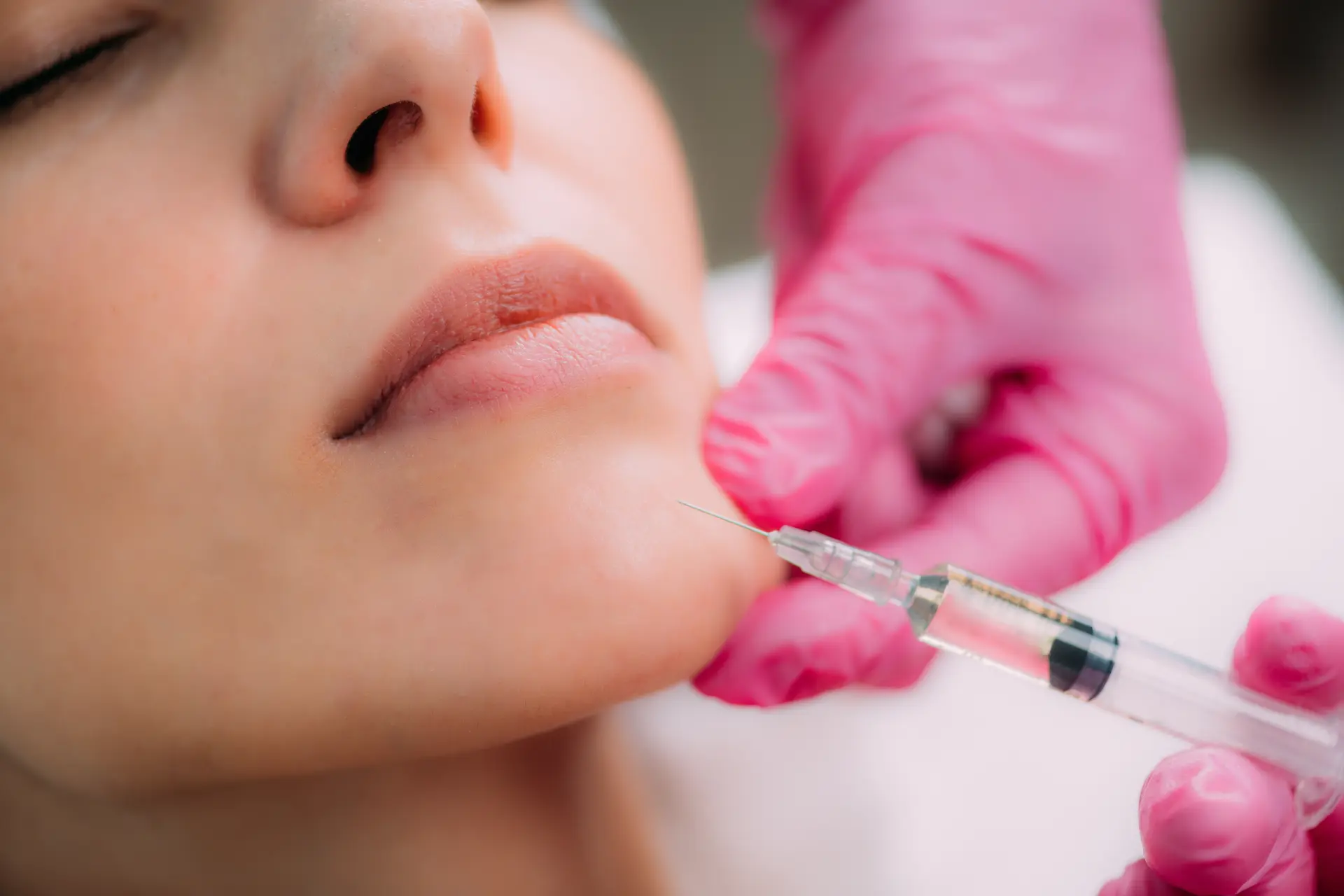dermal-filler-injection-chin