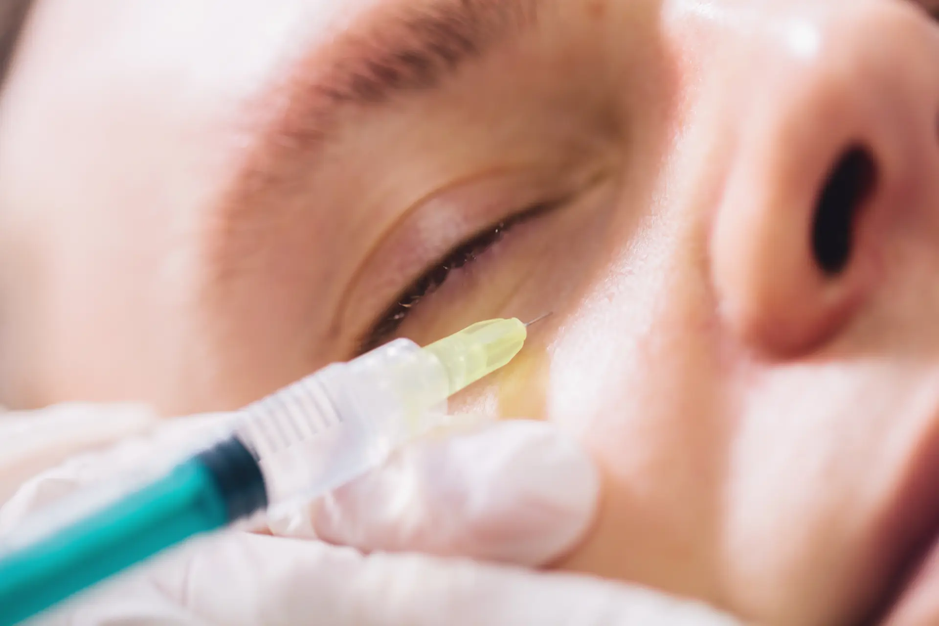 dermal-filler-injection-near-eye-close-up-2026-03-25-03-56-41-utc