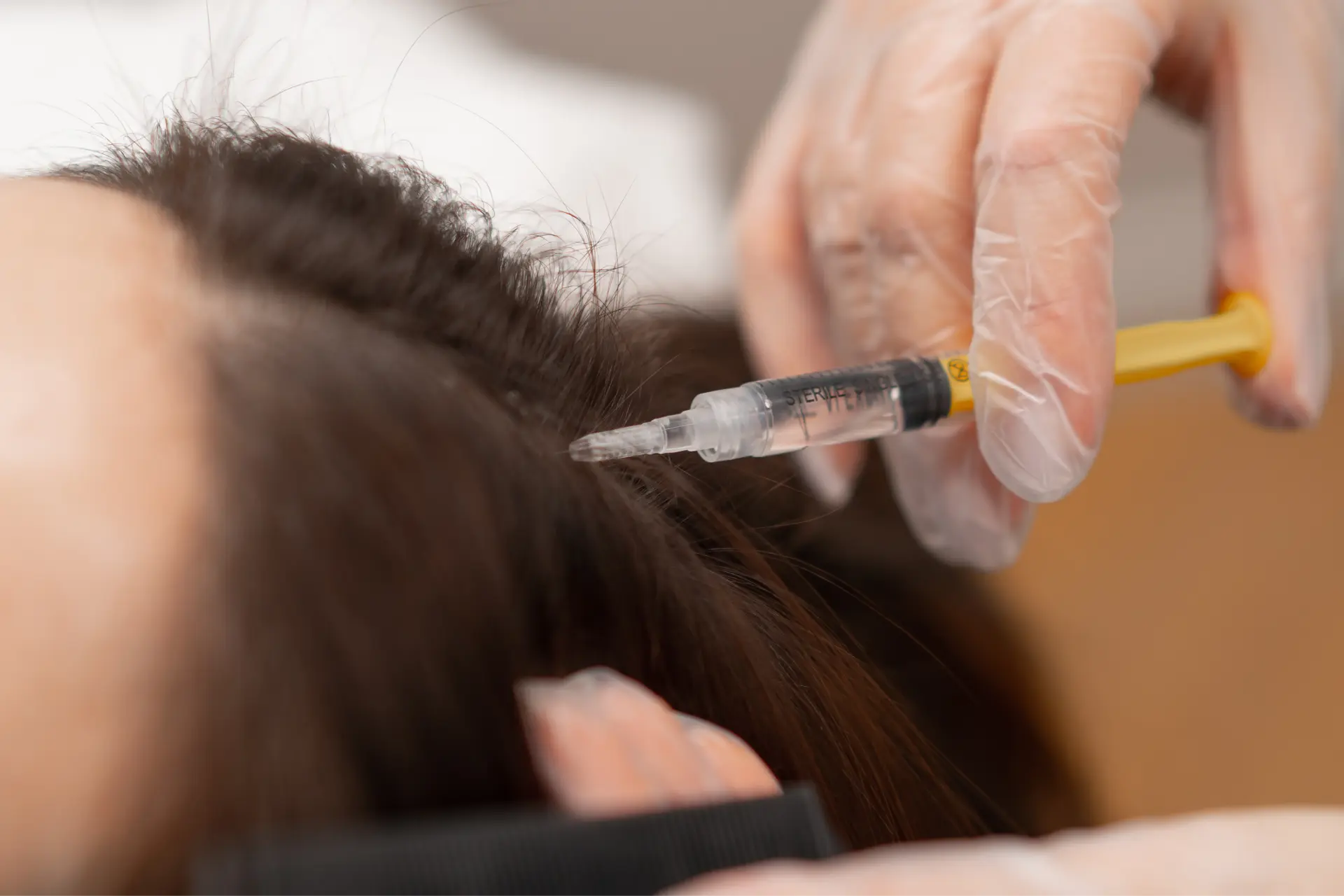 hair-treatment-injection-being-administered-by-doc-2026-03-13-05-29-51-utc