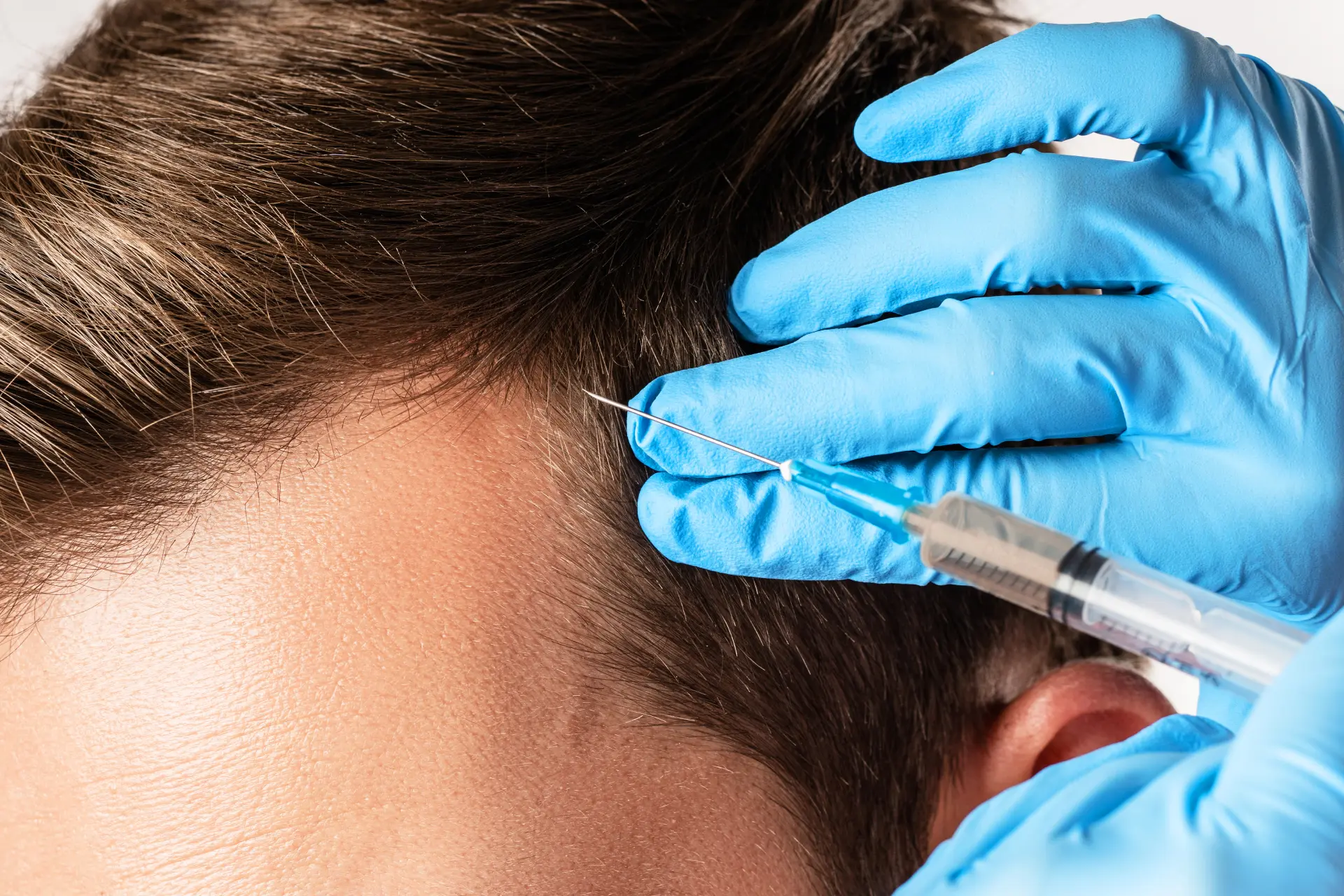 hair-treatment-with-syringe-by-professional-2026-01-05-05-42-21-utc