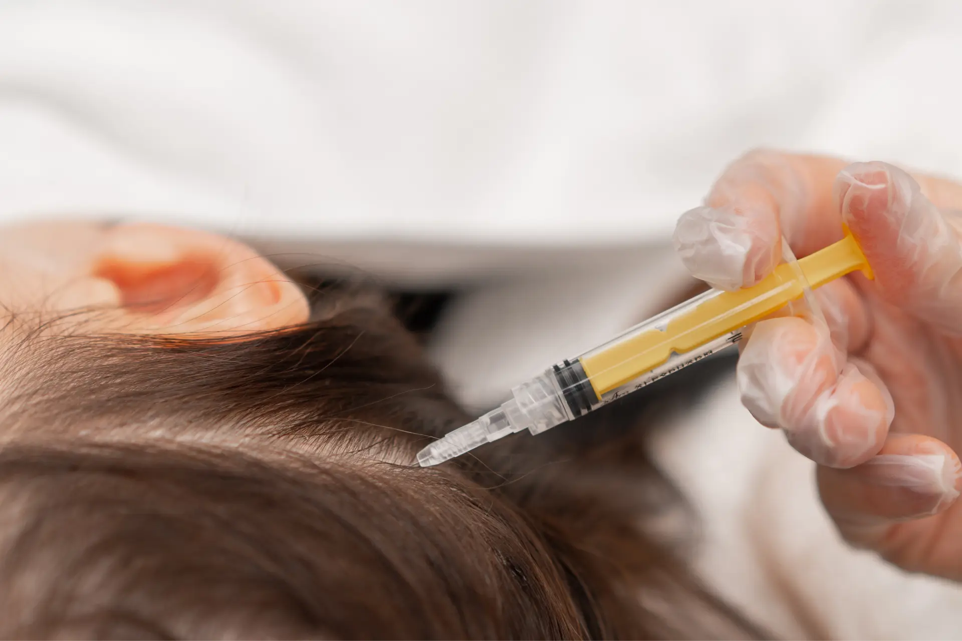 injection-applied-on-head-of-a-patient-2026-03-13-04-12-06-utc