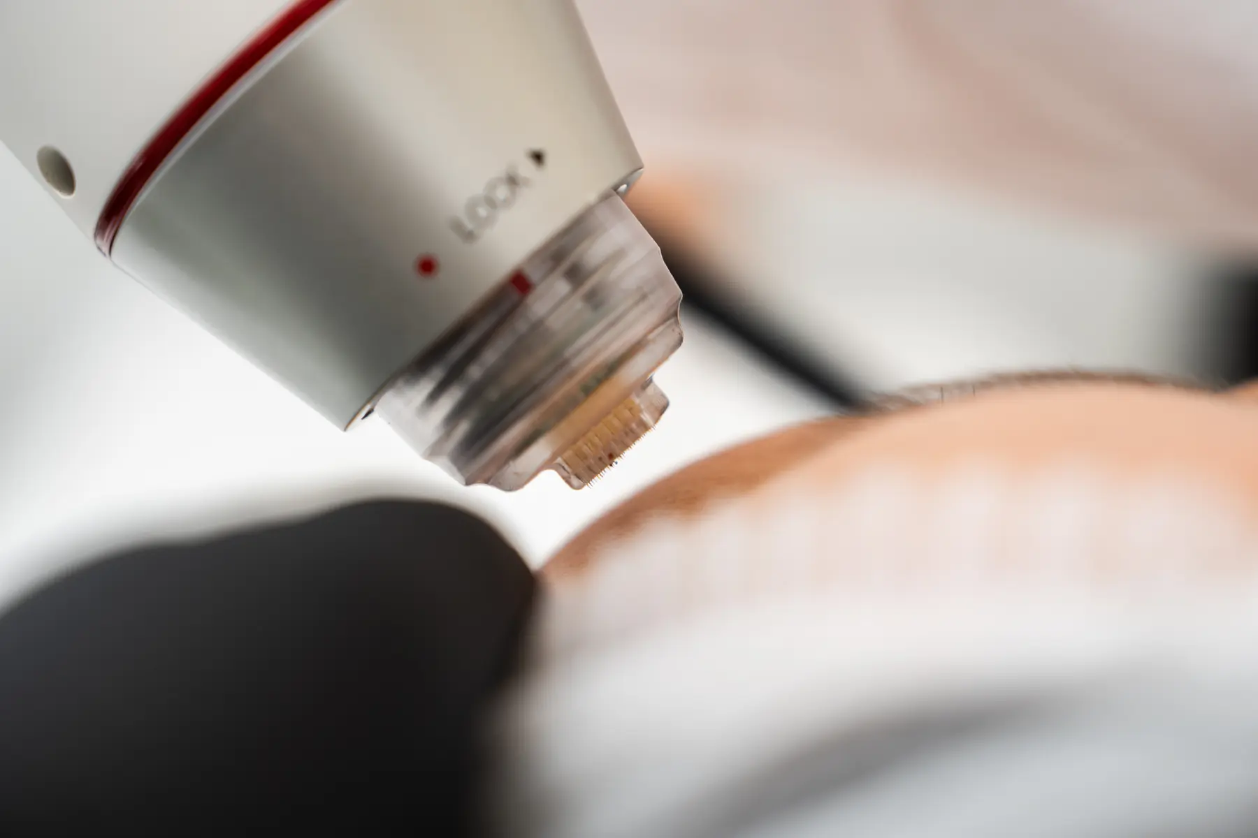 laser-treatment-session-for-skin-rejuvenation-in-a-2026-03-24-00-27-37-utc