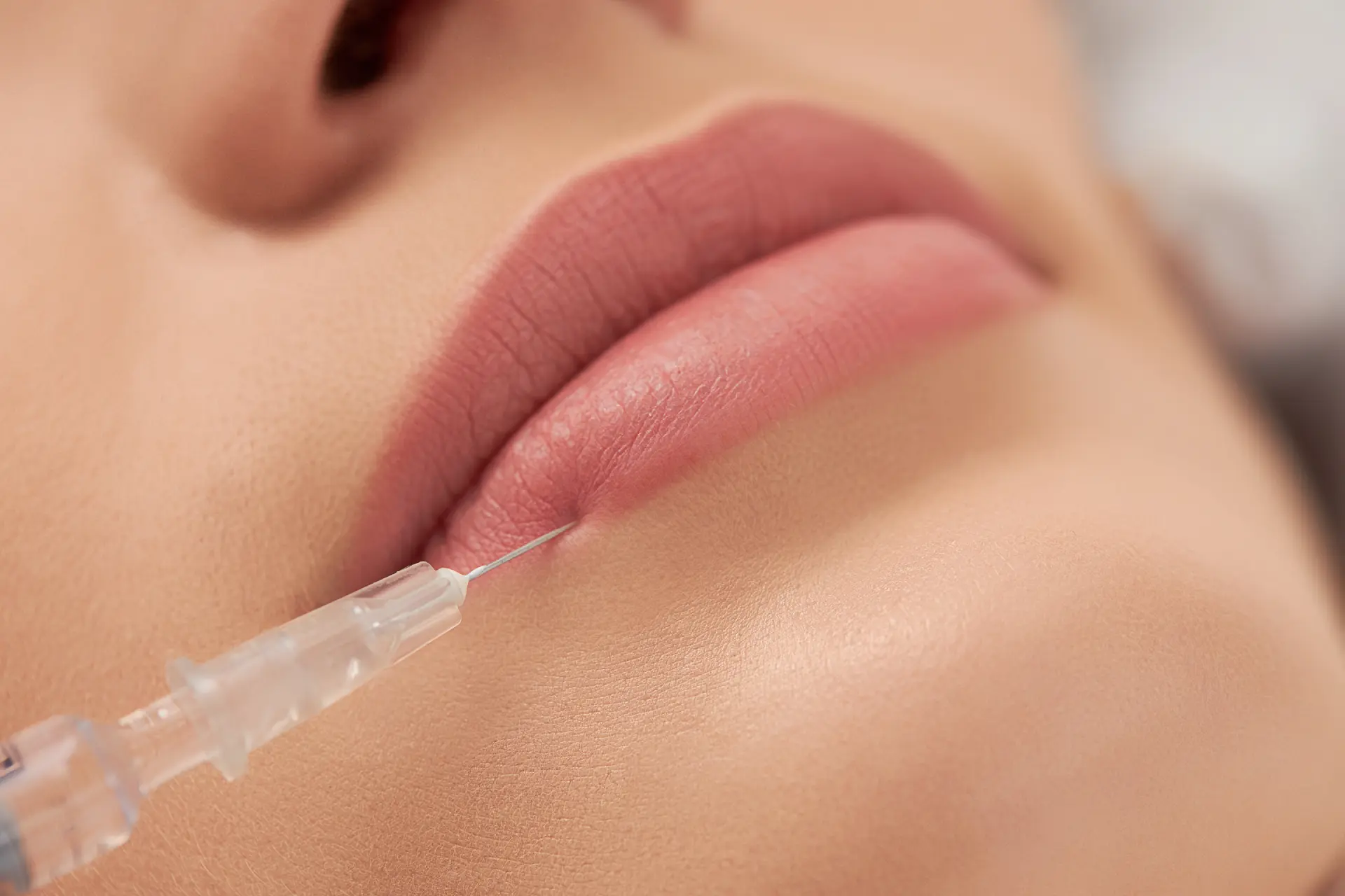 procedure-lip-augmentation-young-beautiful-woman