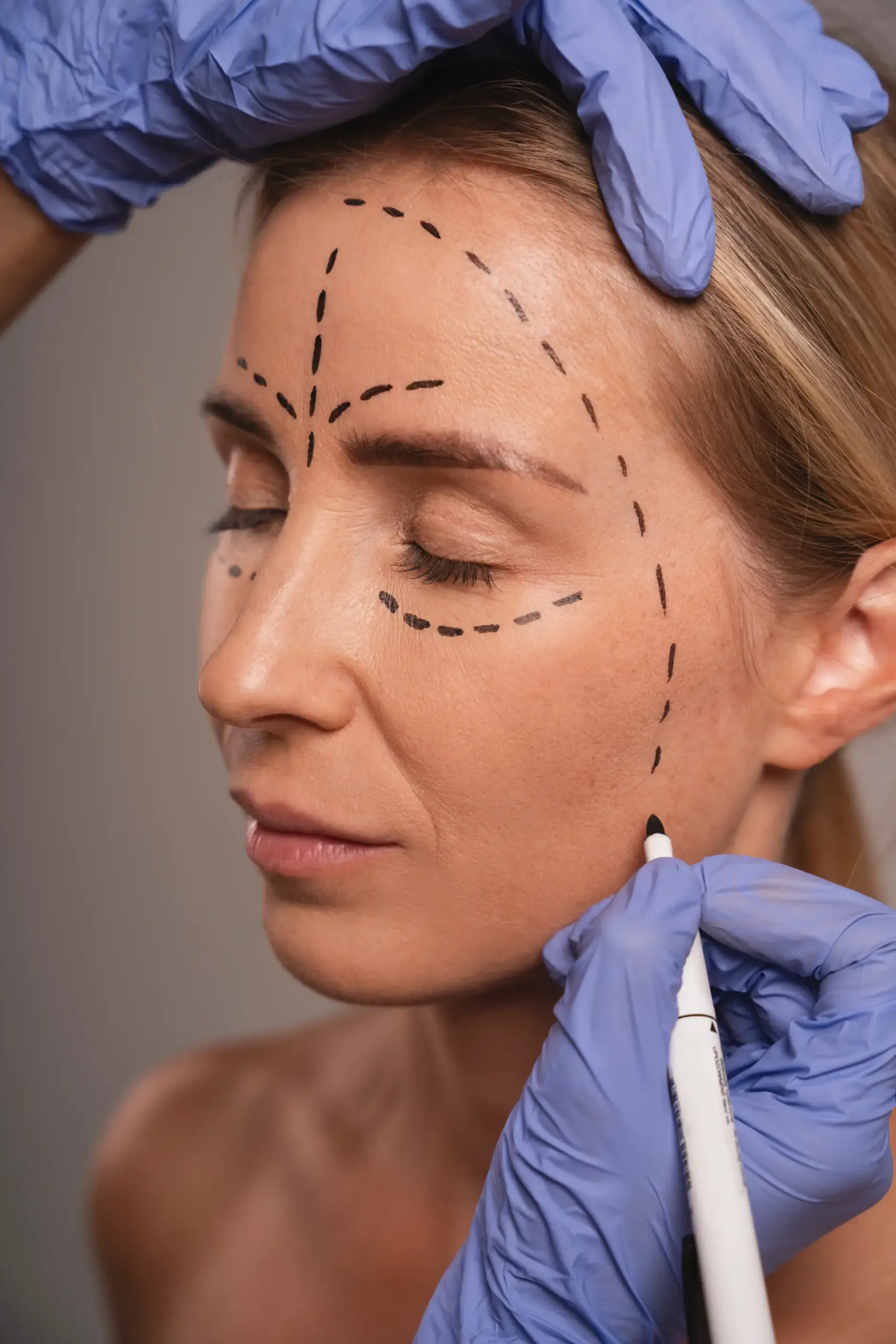 woman-preparing-cosmetic-surgery