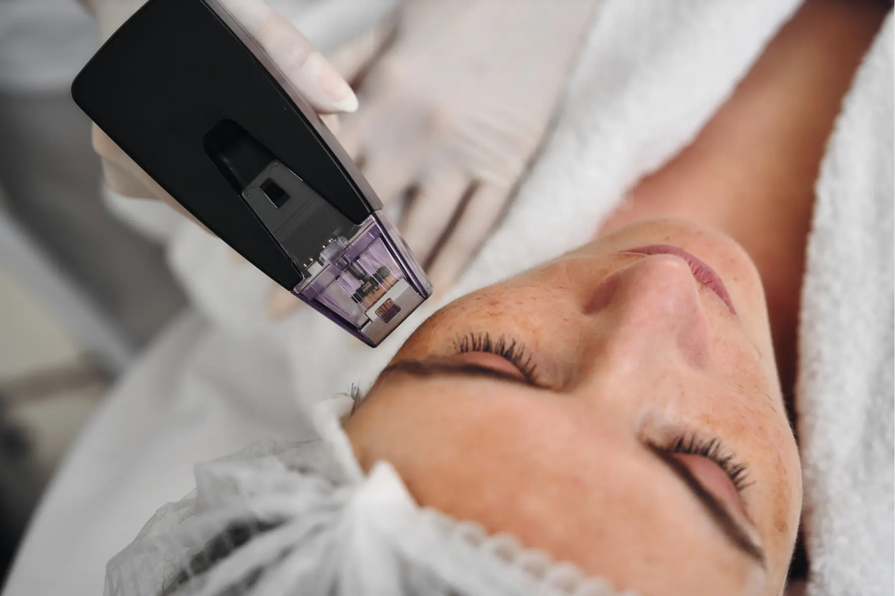 woman-receiving-facial-treatment-at-medical-spa-2026-03-20-00-17-08-utc