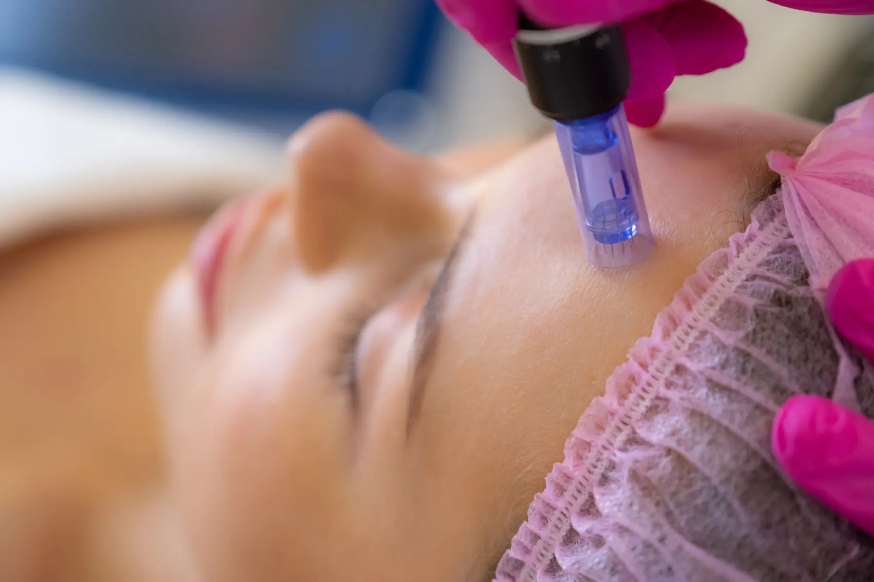 woman-receiving-facial-treatment-at-modern-clinic-2026-03-16-00-38-42-utc